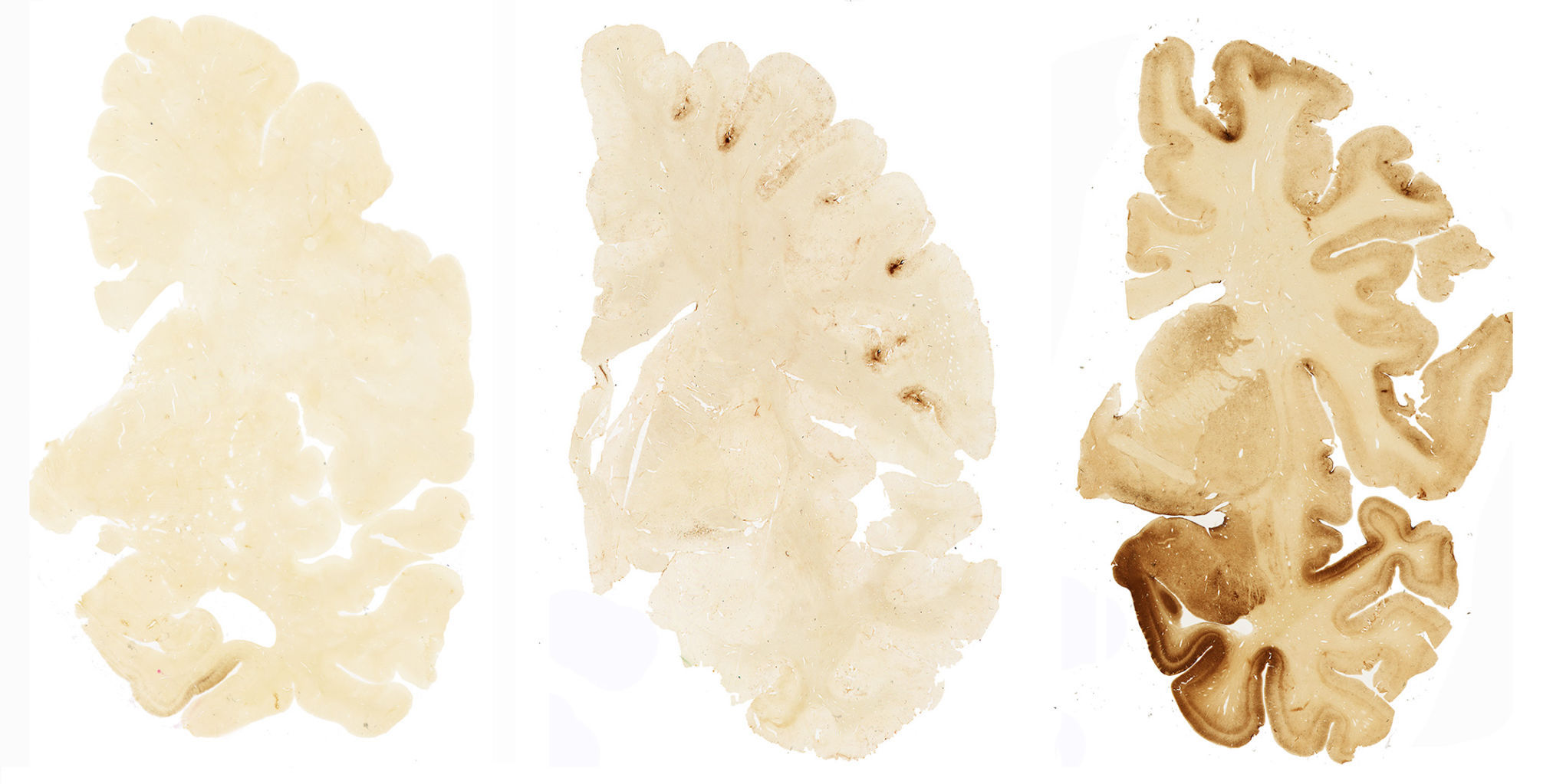 Brain scans
